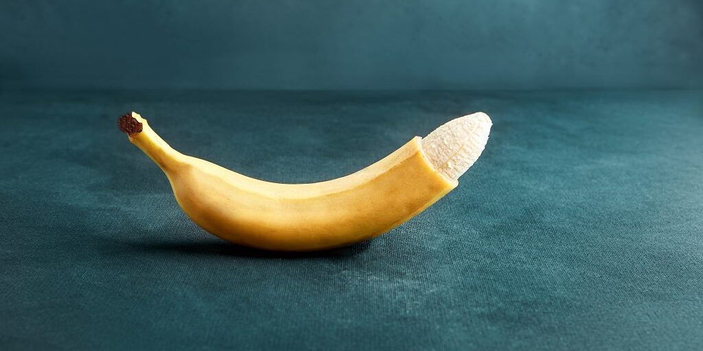 Τι είναι η περιτομή Τι είναι η περιτομή