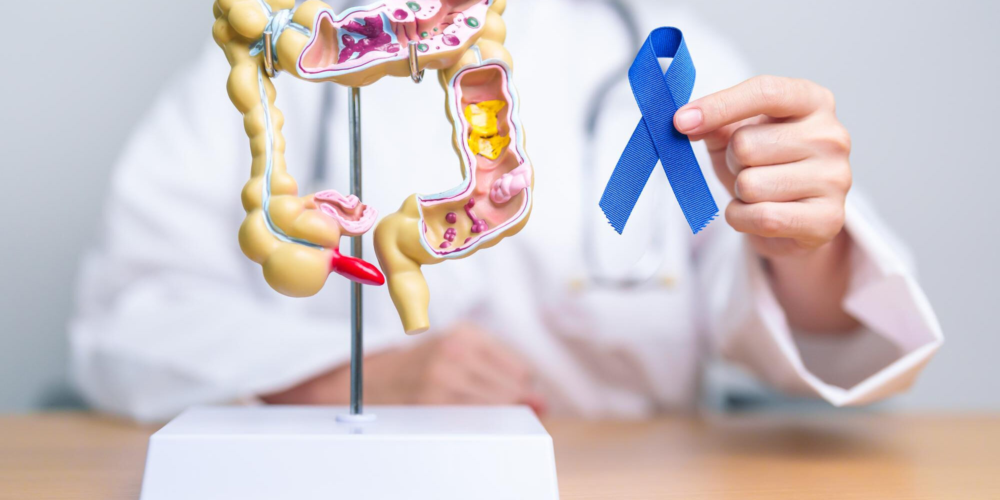 Τι είναι ο καρκίνος παχέος εντέρου Τι είναι ο καρκίνος παχέος εντέρου