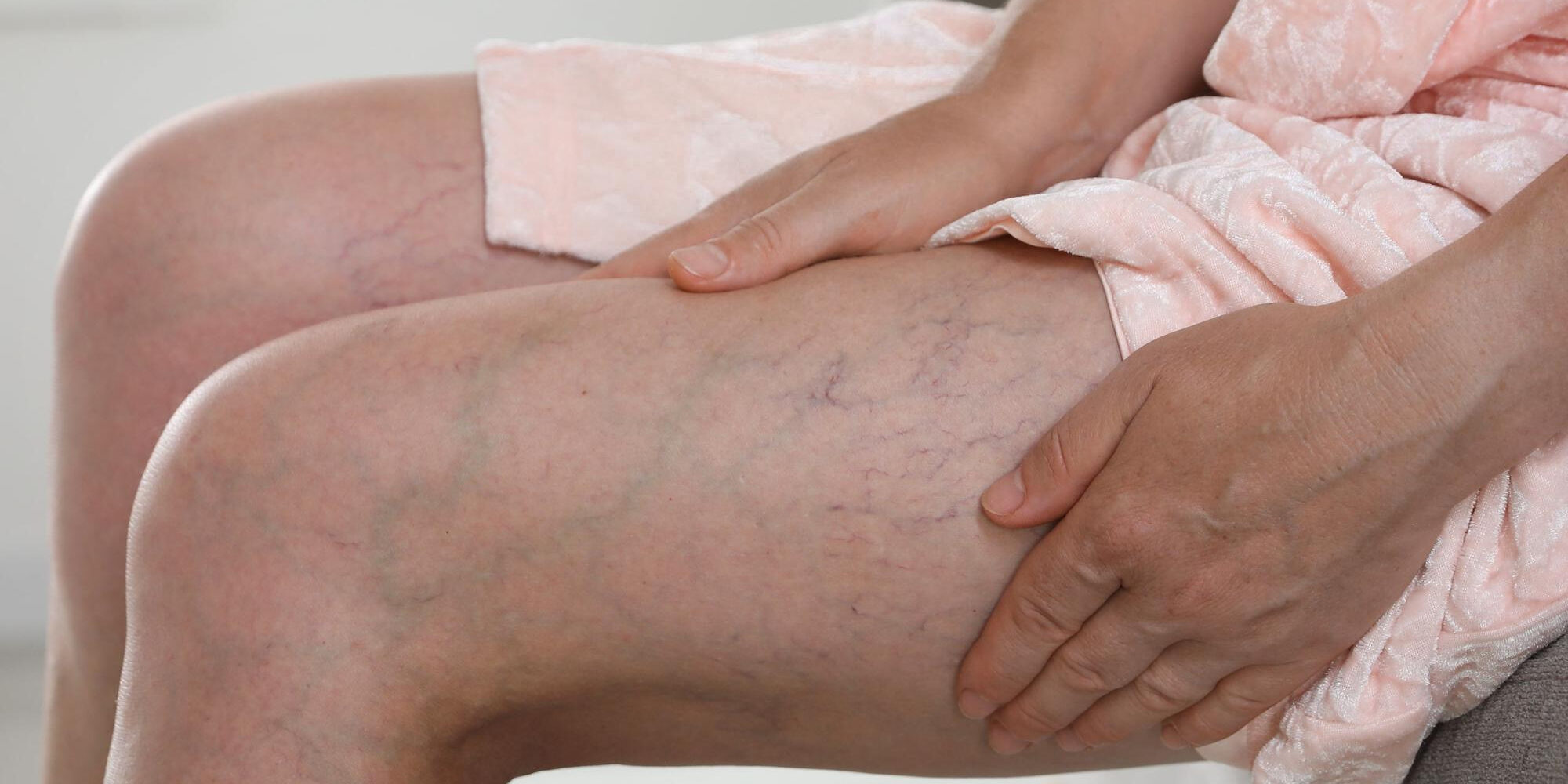 Τι είναι η Φλεβική Ανεπάρκεια