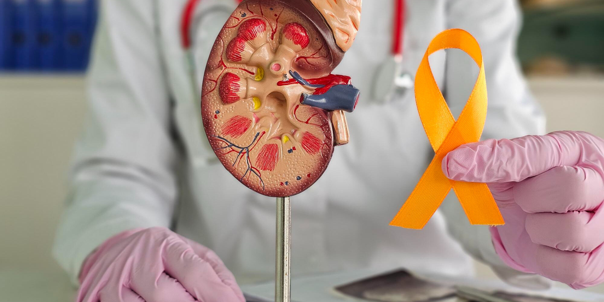 Τι είναι ο καρκίνος νεφρού