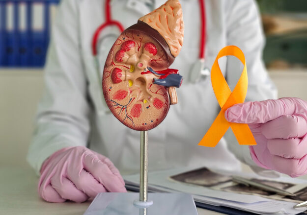 Τι είναι ο καρκίνος νεφρού