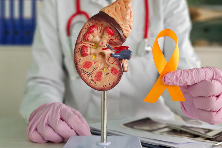 Τι είναι ο καρκίνος νεφρού Τι είναι ο καρκίνος νεφρού