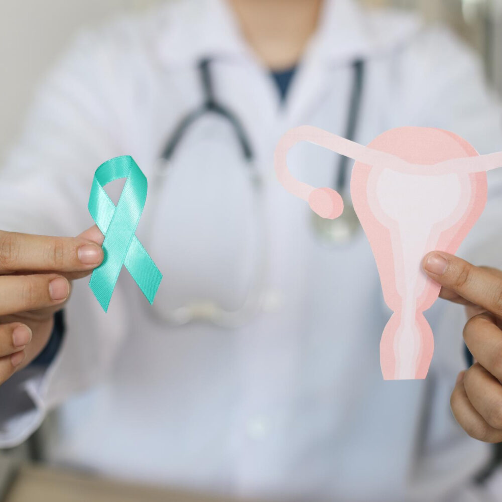 καρκίνος ωοθηκών