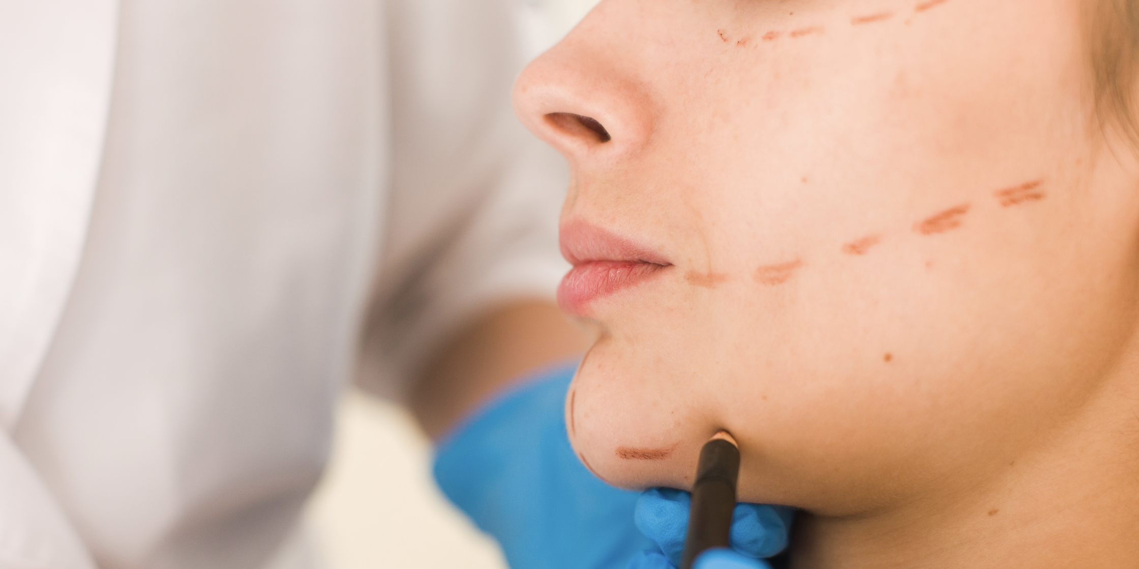 times plastikwn epemvasewn