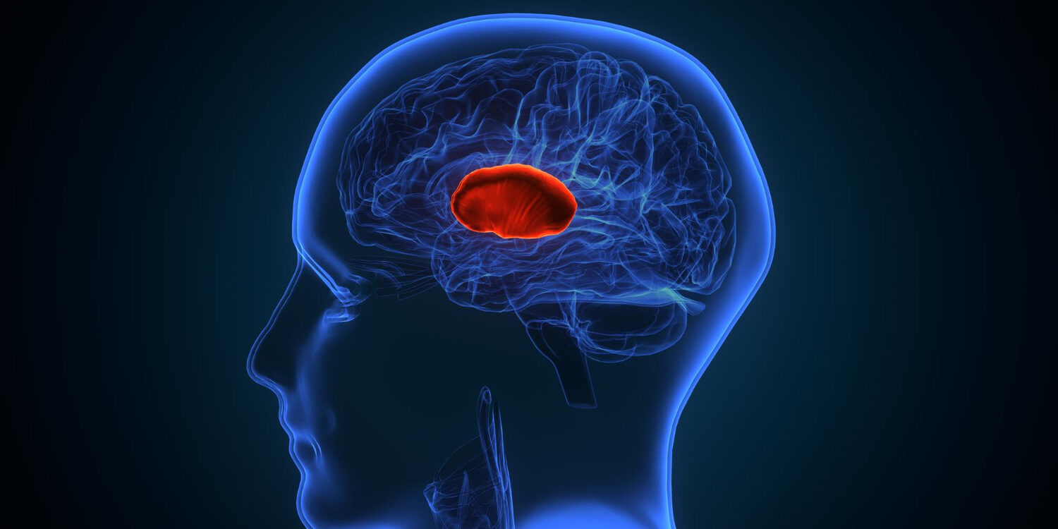 Όγκος-εγκεφάλου-συμπτώματα Όγκος-εγκεφάλου-συμπτώματα