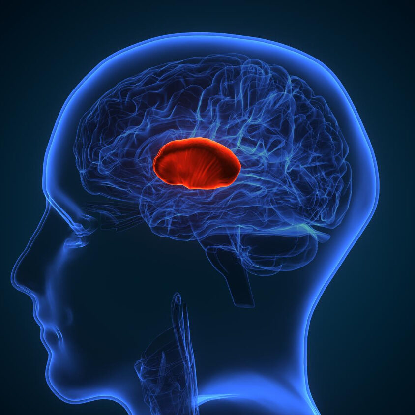 Όγκος-εγκεφάλου-συμπτώματα
