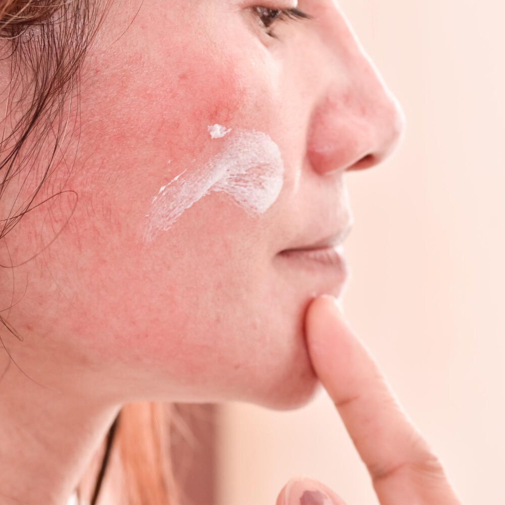 δερματίτιδα στο πρόσωπο