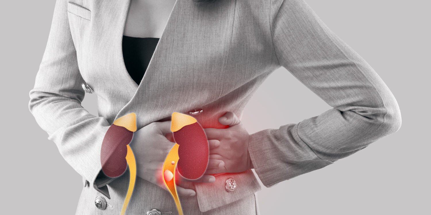 Πέτρες στα νεφρά Πέτρες στα νεφρά