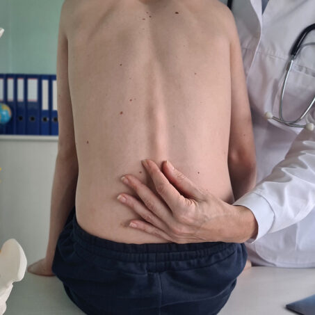 διορθώνεται η κύφωση