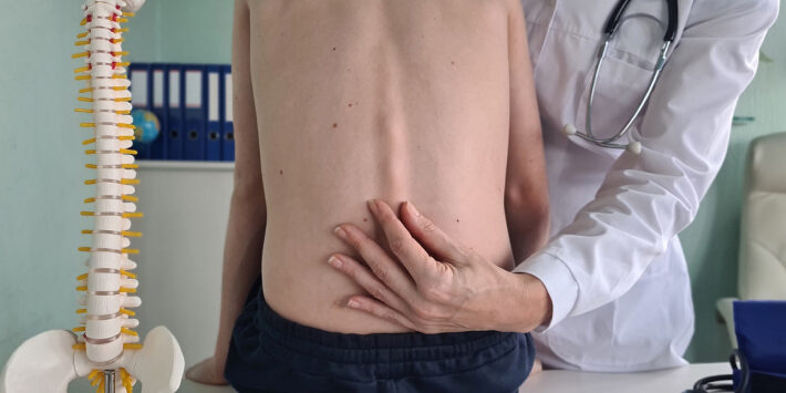 διορθώνεται η κύφωση