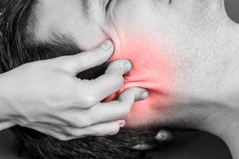 νευραλγία τριδύμου