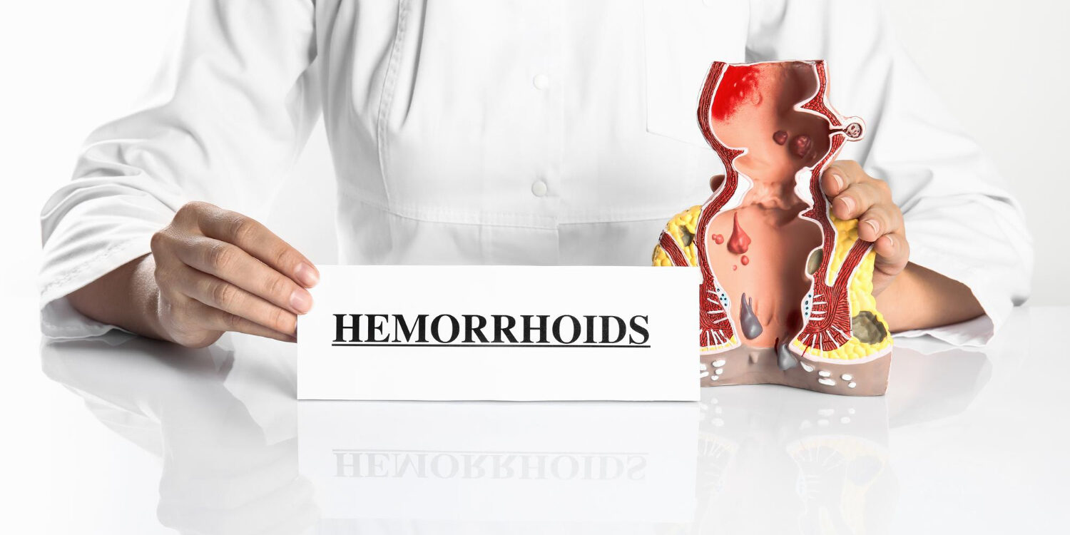 Η γρήγορη λύση για τις αιμορροΐδες Η γρήγορη λύση για τις αιμορροΐδες