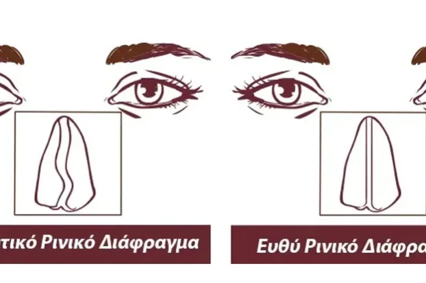 kaliteroi xeirourgoi orl gia diafragma