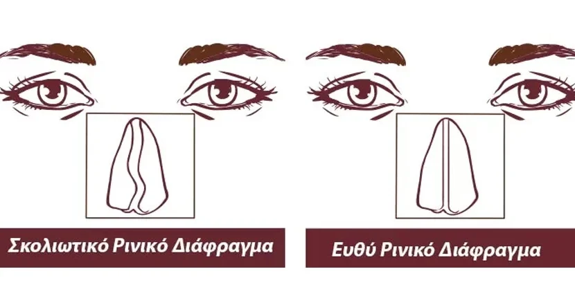 kaliteroi xeirourgoi orl gia diafragma kaliteroi xeirourgoi orl gia diafragma