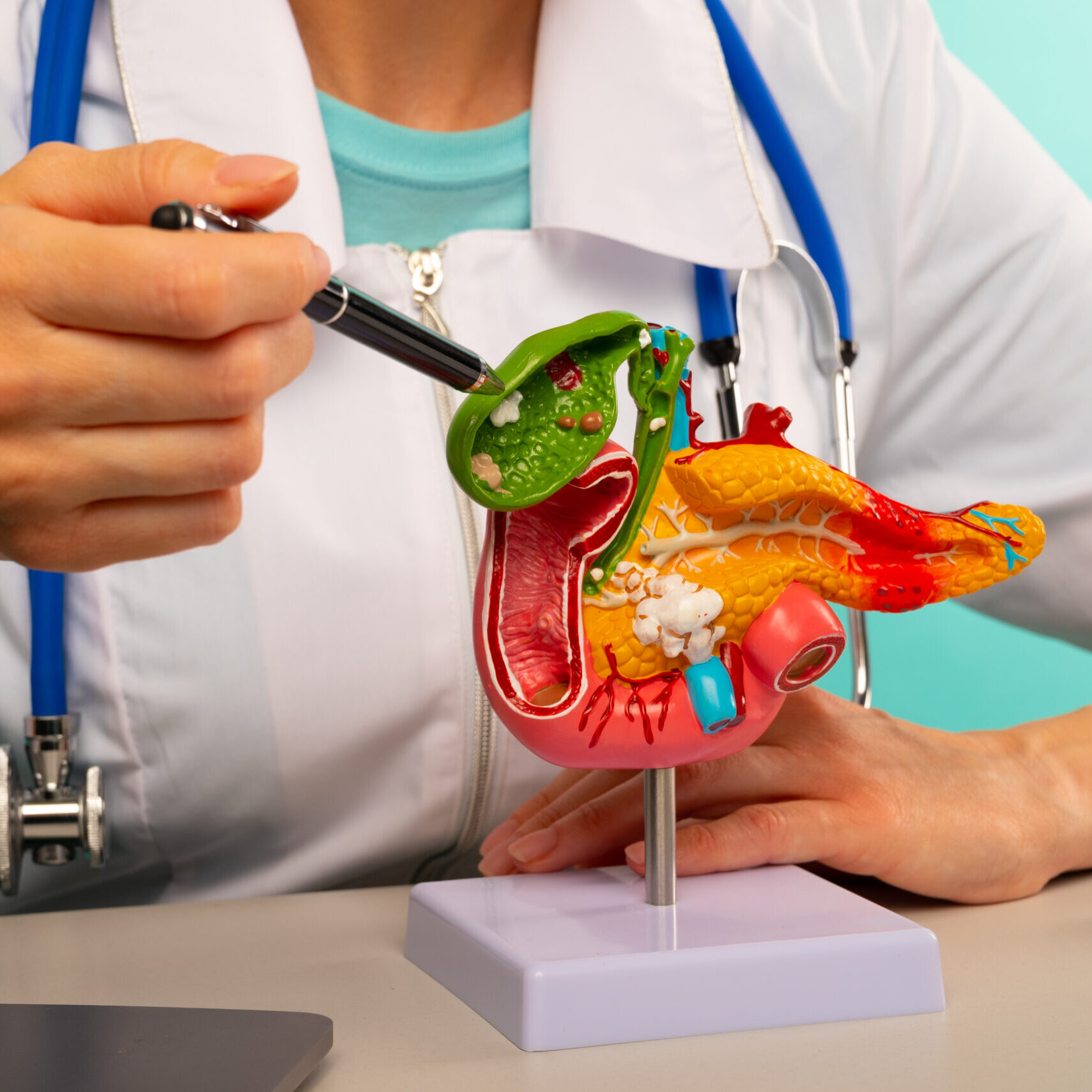 Χοληδοχολιθίαση