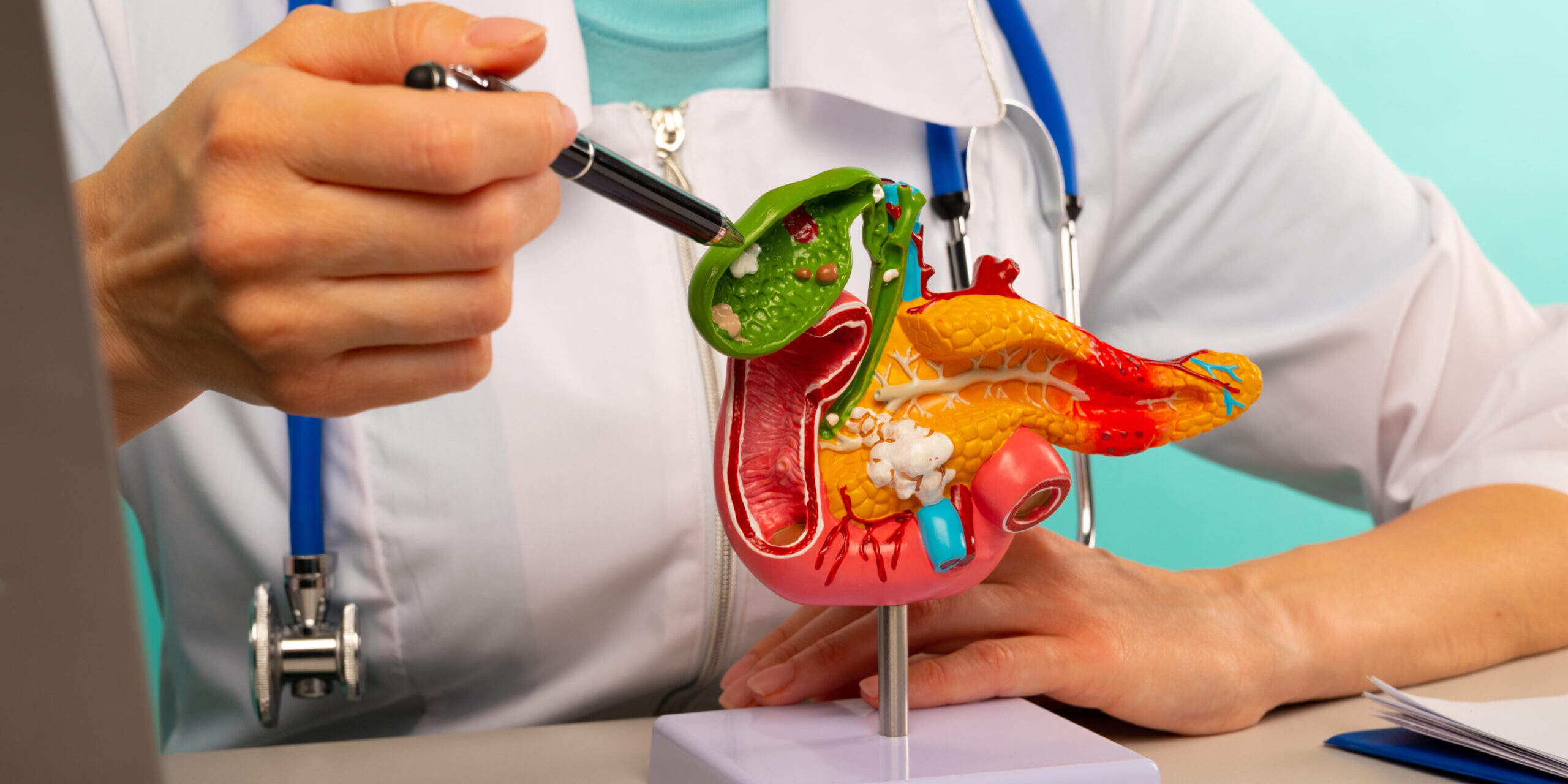 Χοληδοχολιθίαση