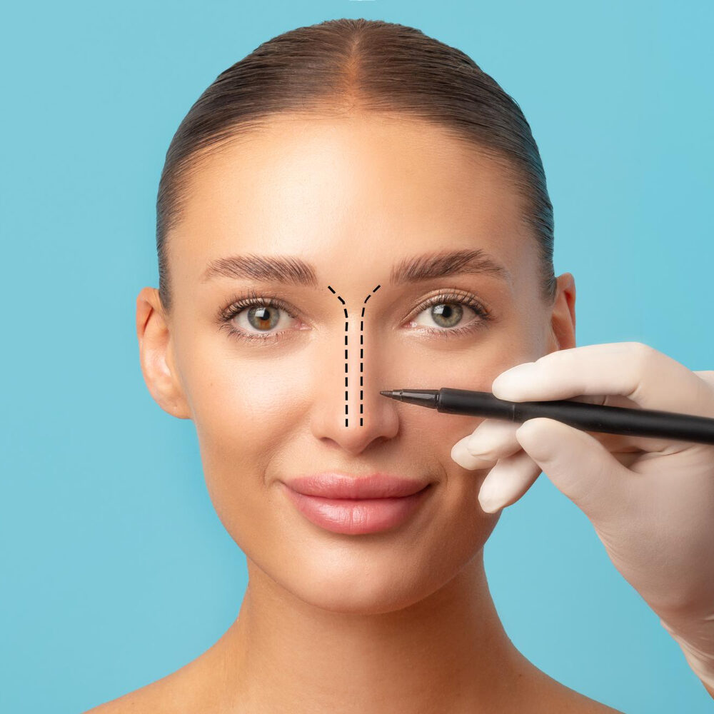 διαφραγμα και ρινοπλαστικη