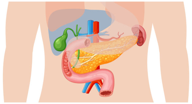 ERCP