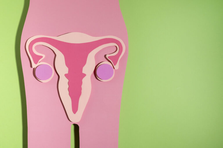 PCOS PCOS