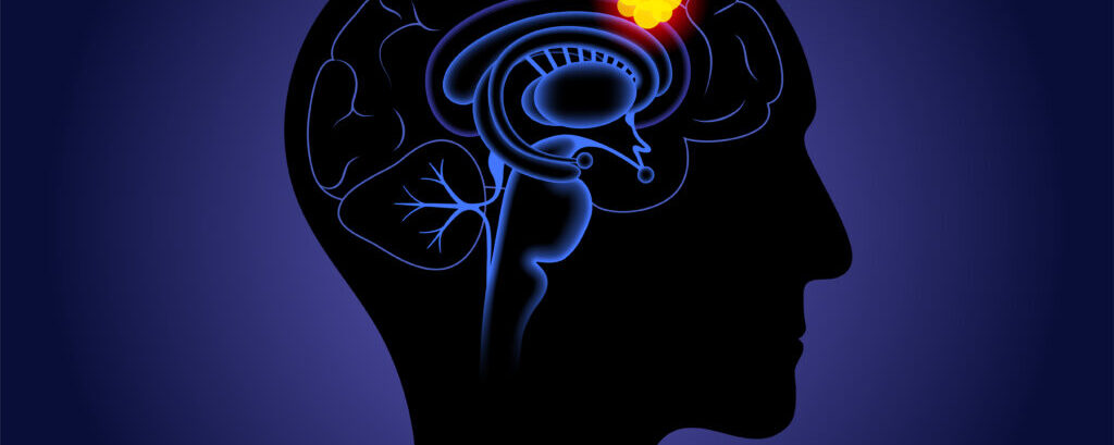 Γλοιοβλάστωμα