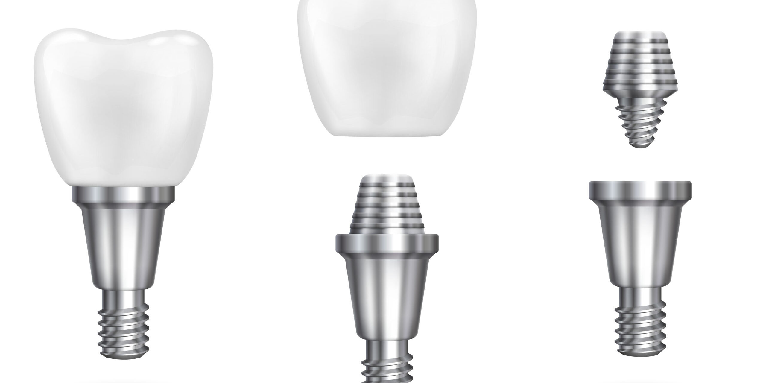 Εμφυτεύματα