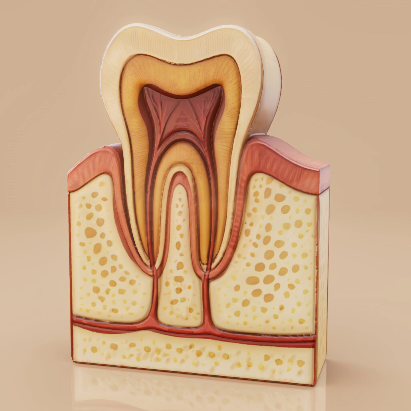 Περιοδοντίτιδα
