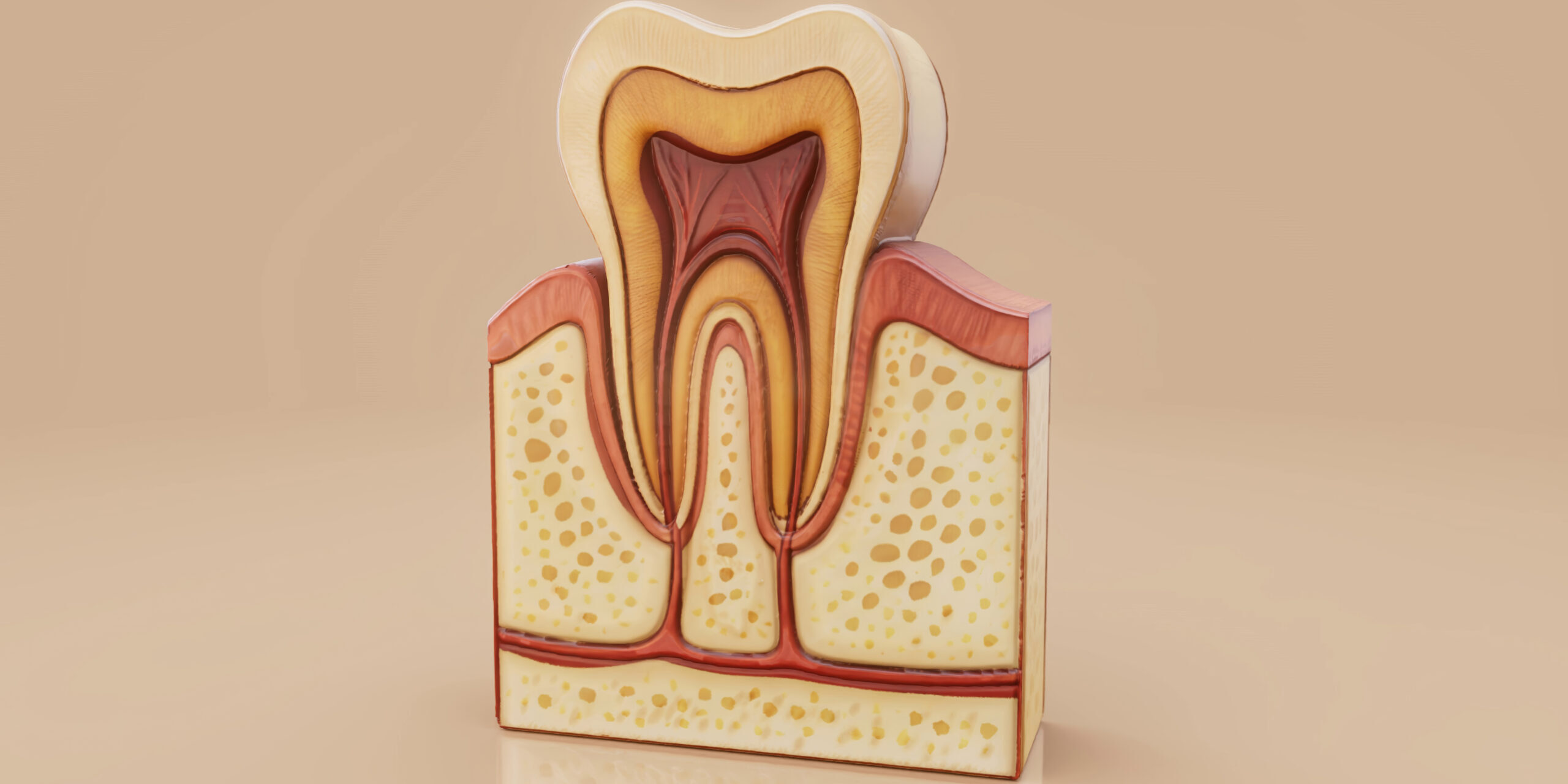 Περιοδοντίτιδα