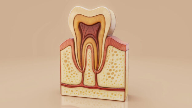 Περιοδοντίτιδα