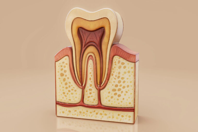 Περιοδοντίτιδα Περιοδοντίτιδα