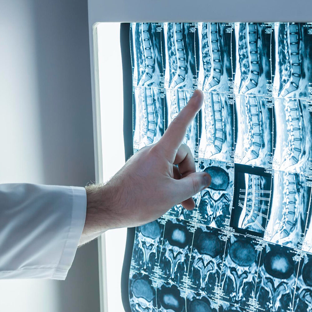 ο καλύτερος χειρουργός για σπονδυλοδεσία