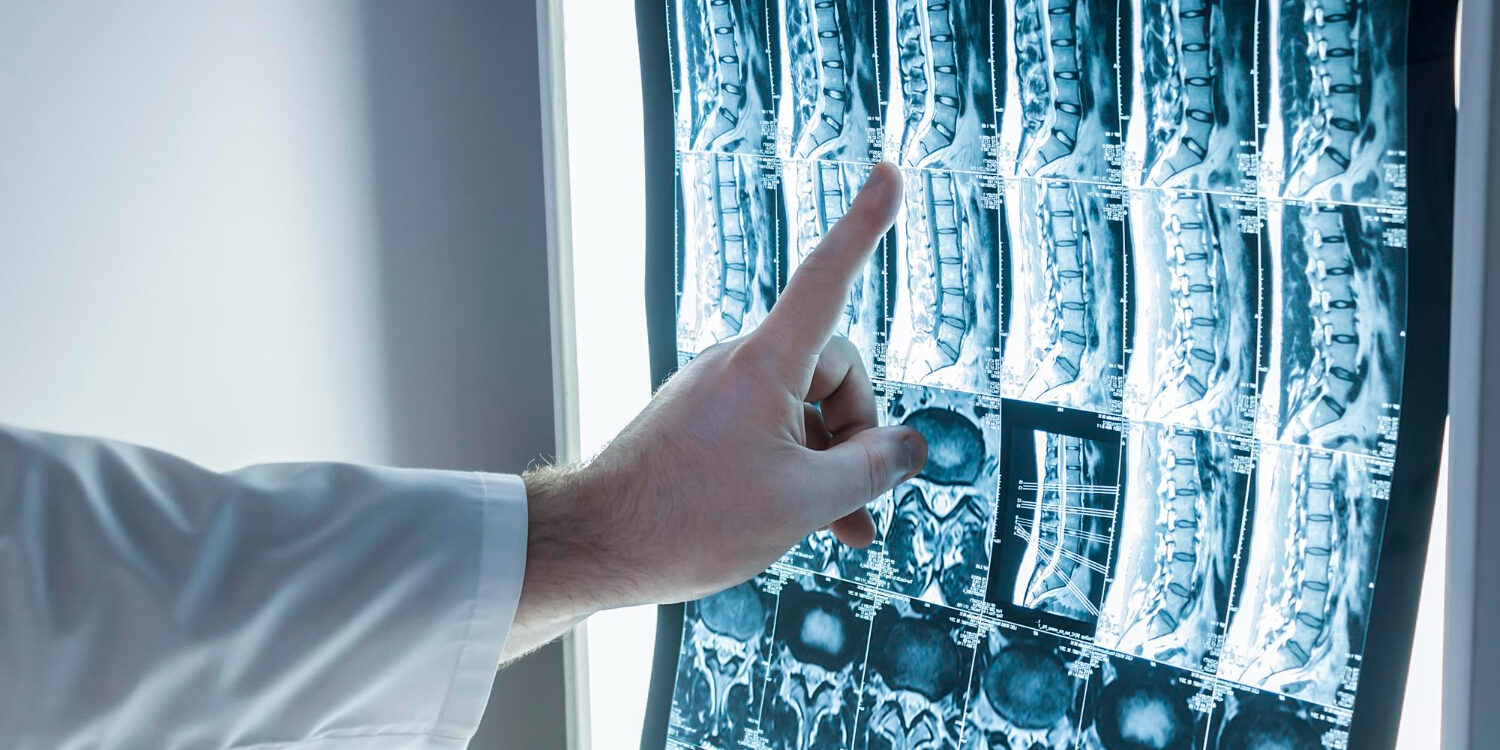 ο καλύτερος χειρουργός για σπονδυλοδεσία