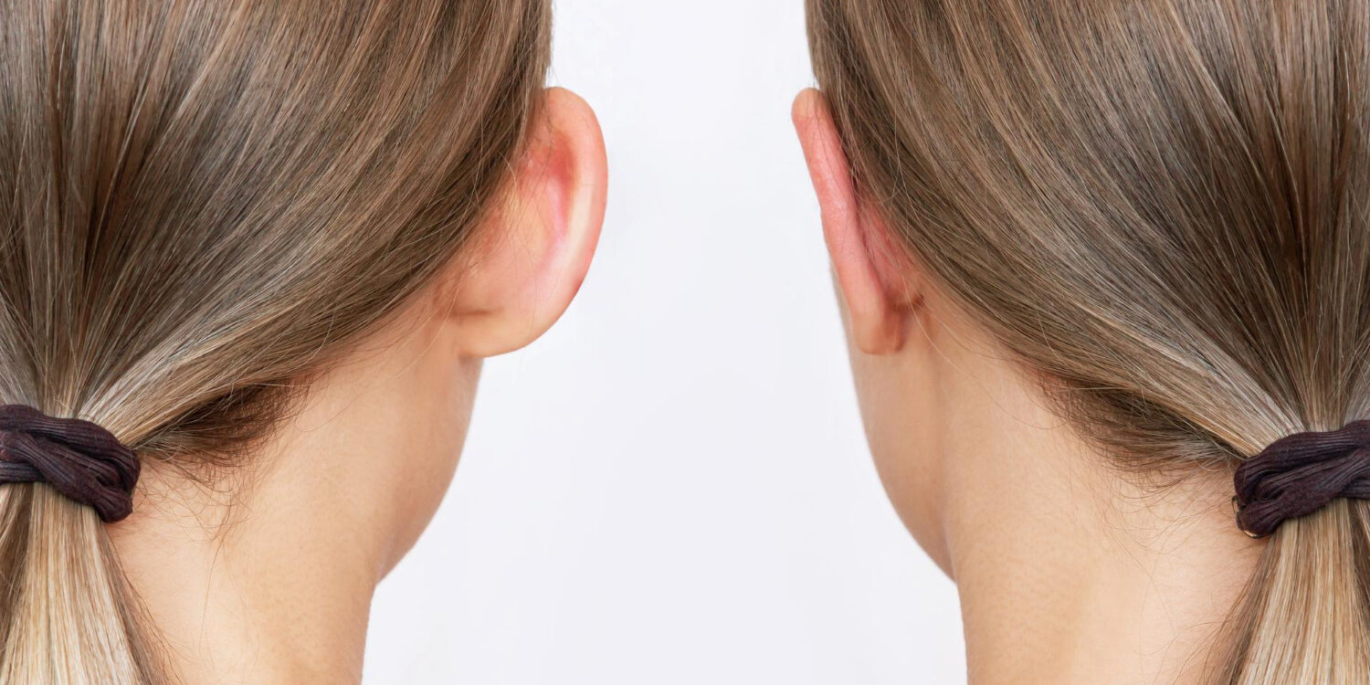 kaliteroi otoplastikoi ellada kaliteroi otoplastikoi ellada