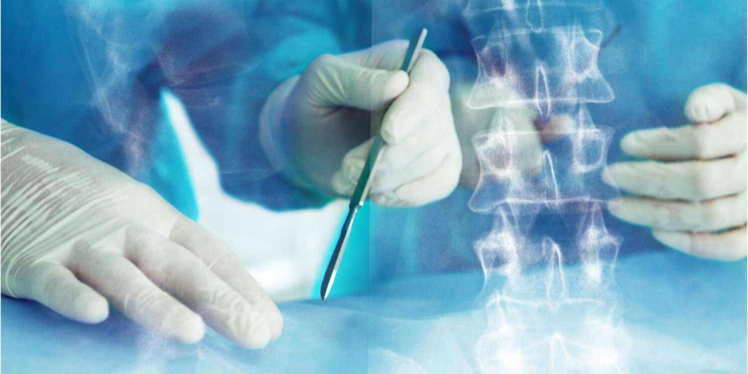 πότε κάνουμε σπονδυλοδεσία