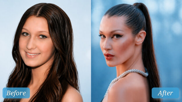 ρινοπλαστική διασήμων