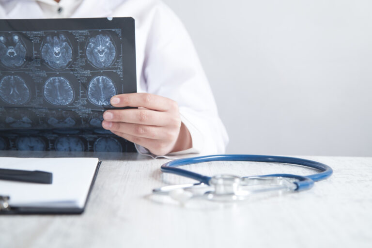 καλύτερος χειρουργός για μηνιγγίωμα εγκεφάλου