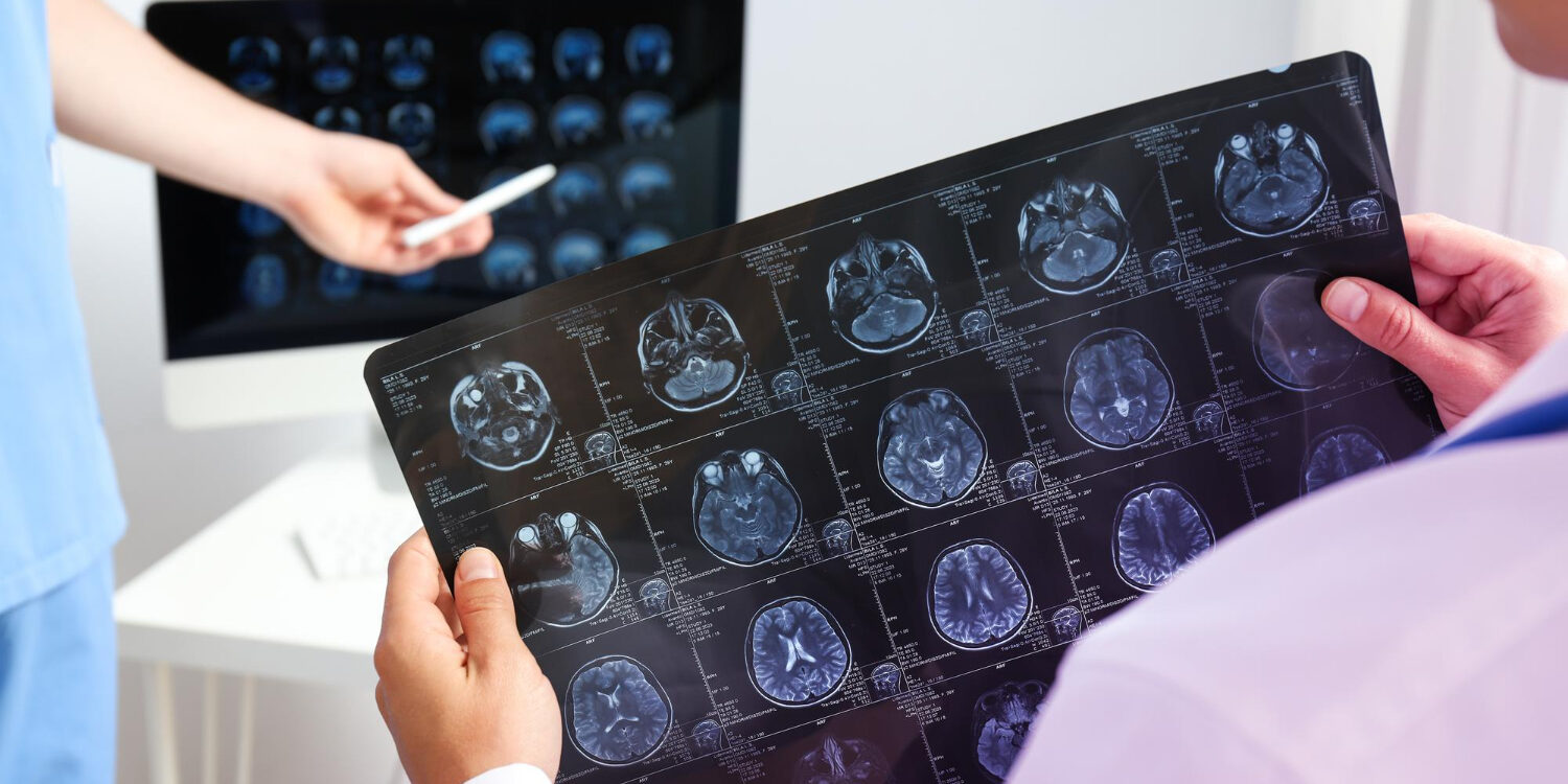 μηνιγγίωμα εγκεφάλου