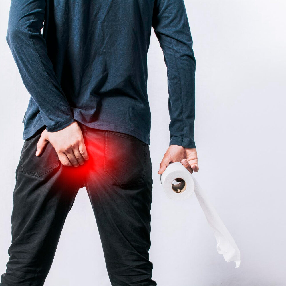 Αιμορροΐδες πόσες μέρες κρατάνε