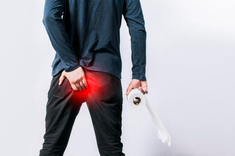 Αιμορροΐδες πόσες μέρες κρατάνε Αιμορροΐδες πόσες μέρες κρατάνε