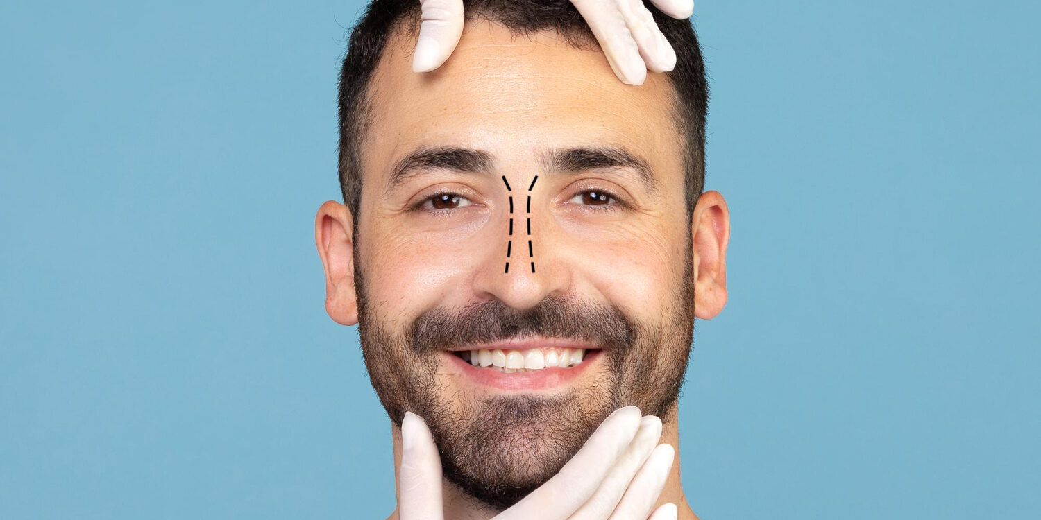 Ρινοπλαστική σε άνδρες: πώς διατηρείται ο ανδρικός χαρακτήρας του προσώπου