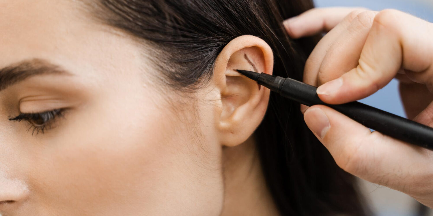 ωτοπλαστική