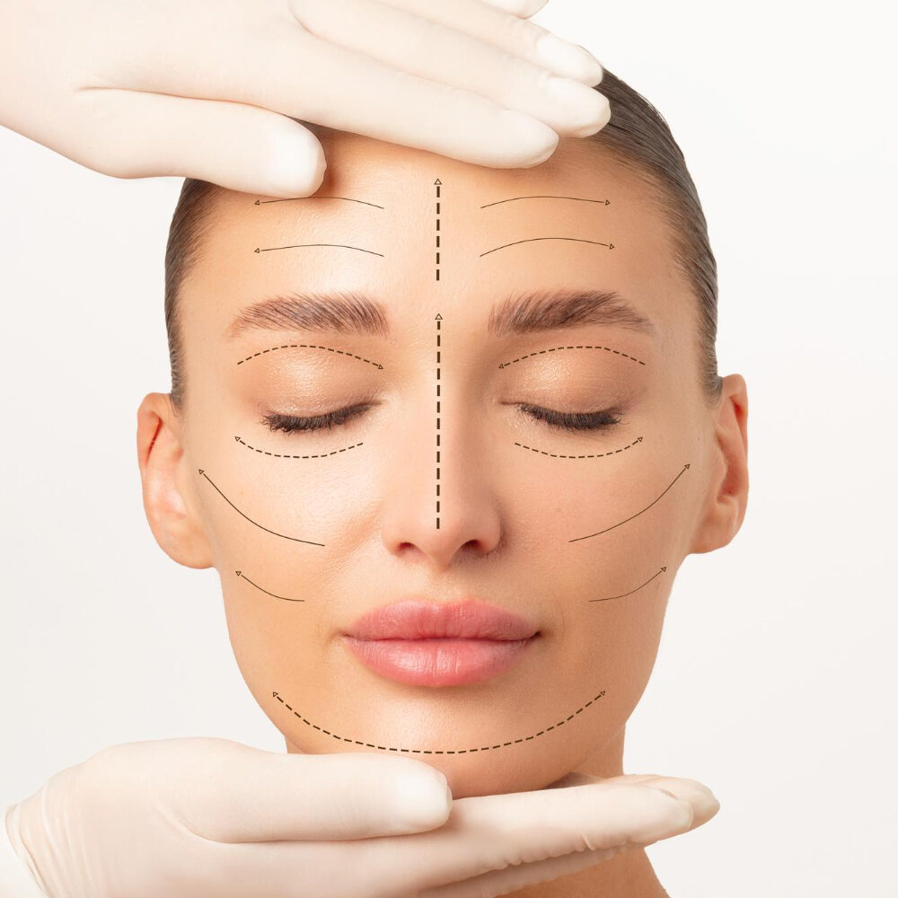 Ultherapy