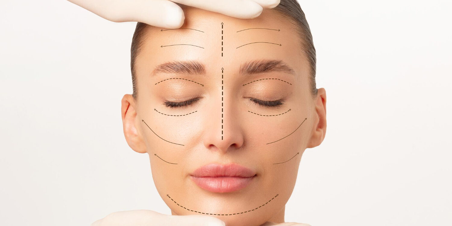 Ultherapy