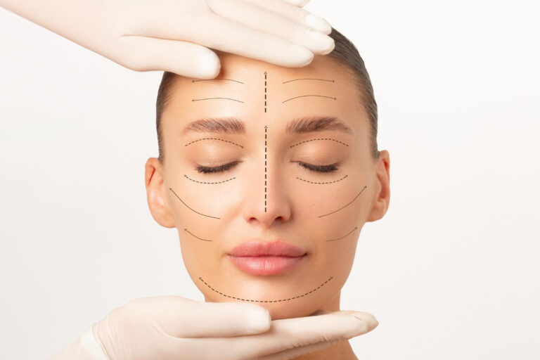 Ultherapy