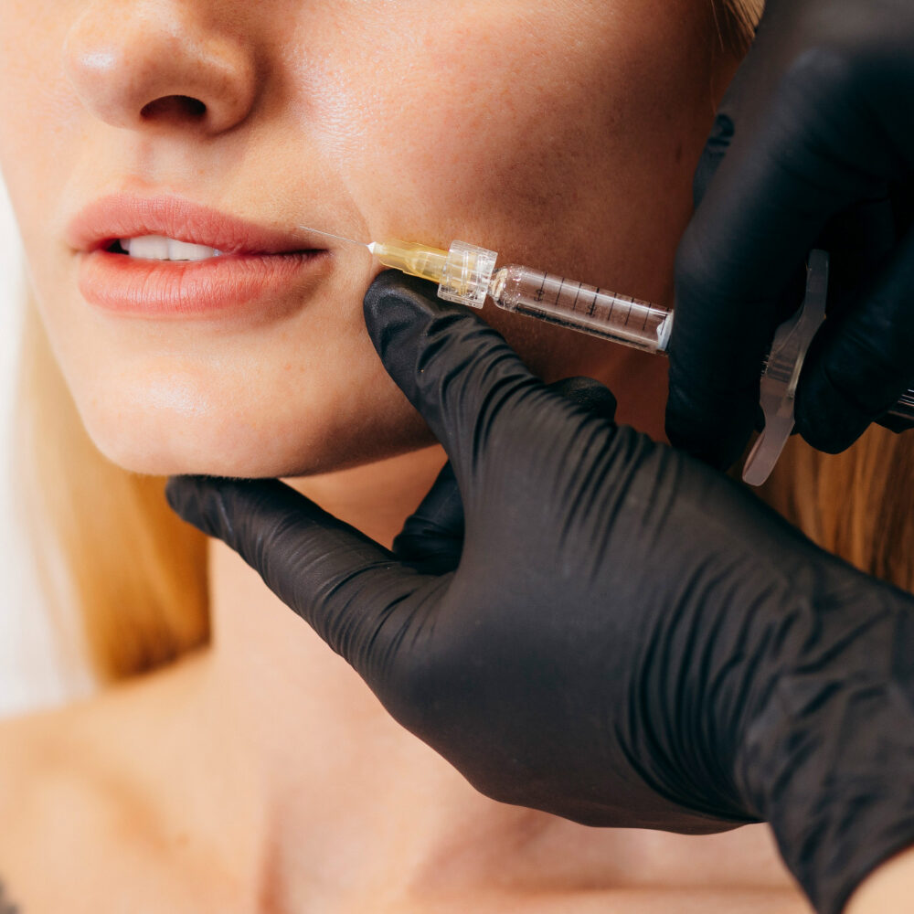 τι είναι τα fillers