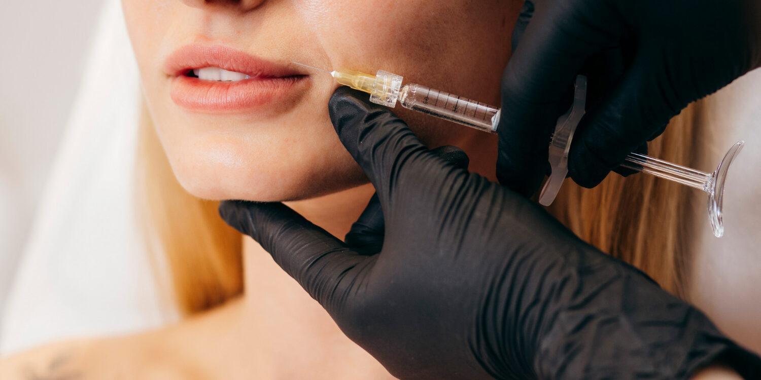 τι είναι τα fillers τι είναι τα fillers