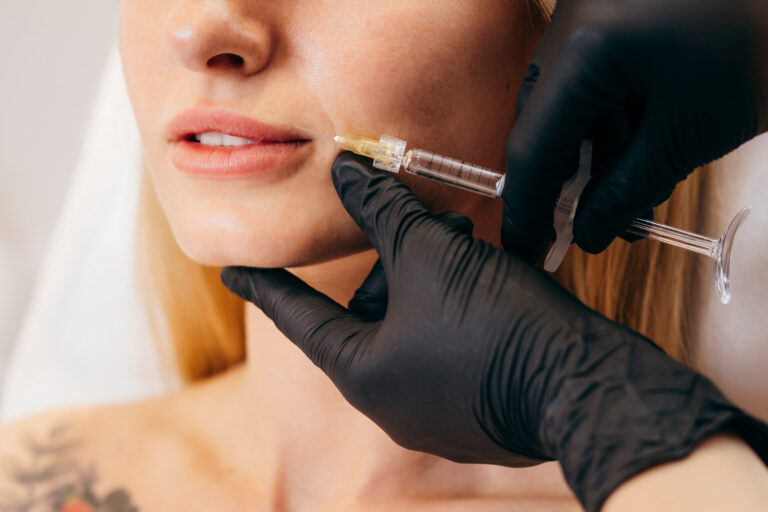 τι είναι τα fillers τι είναι τα fillers