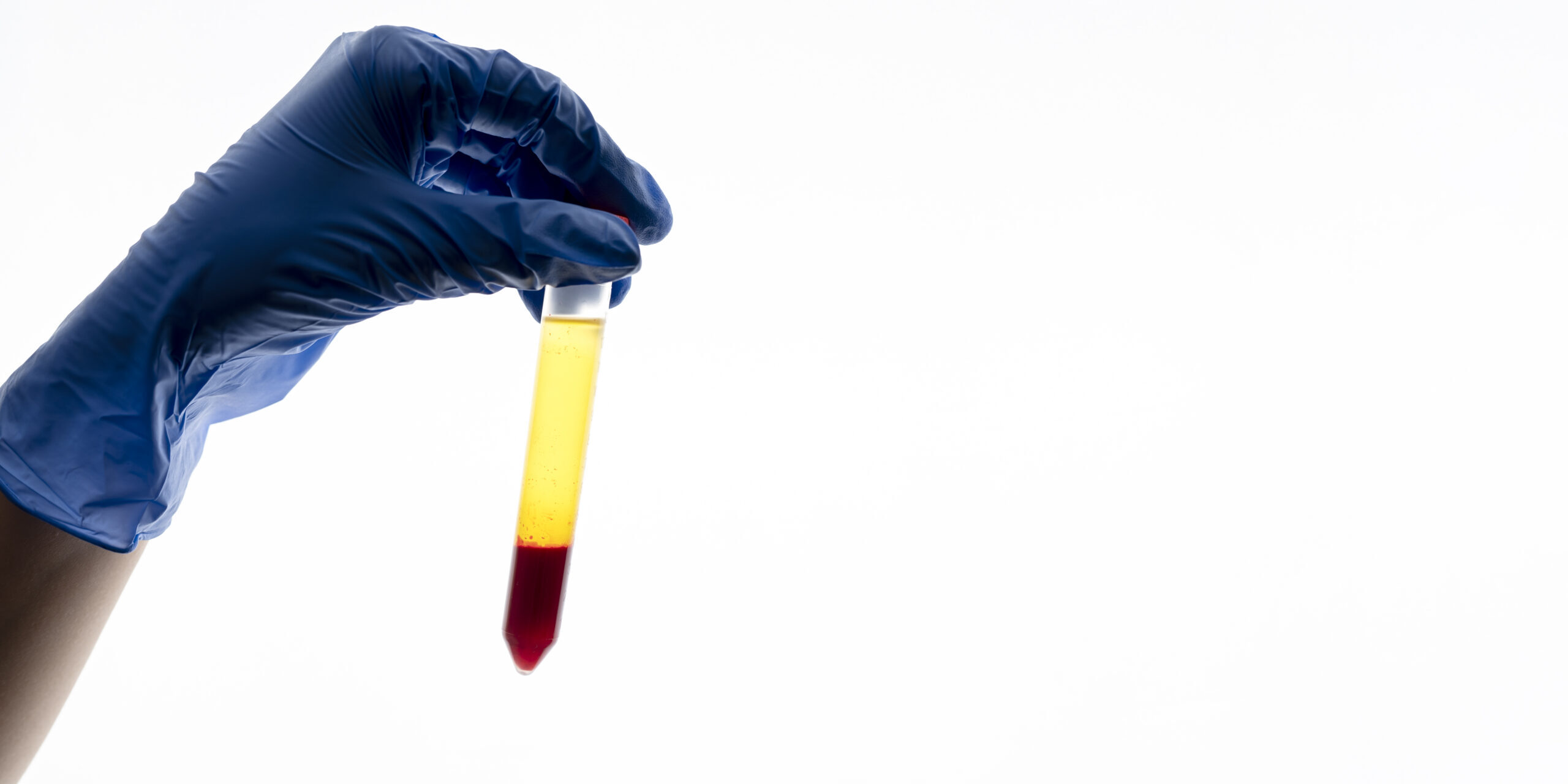 blood in urine blood in urine