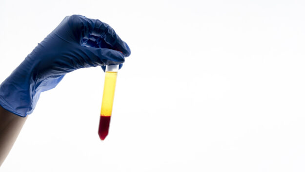 blood in urine