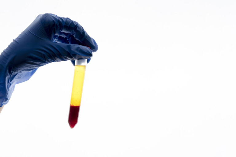 blood in urine