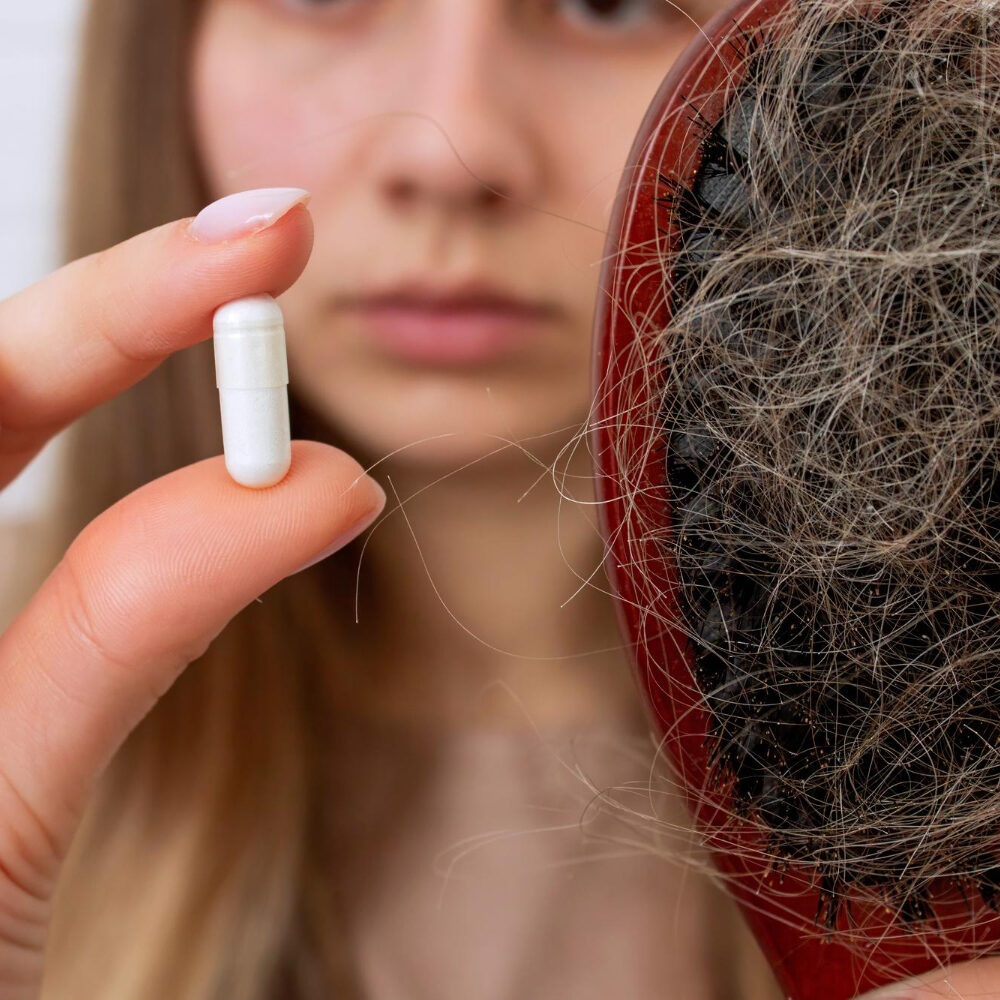hair loss treatments